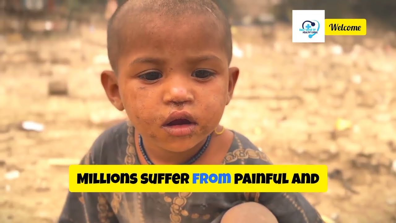 Worms in Your Blood? TheTerrifying Reality of Filarial Infections