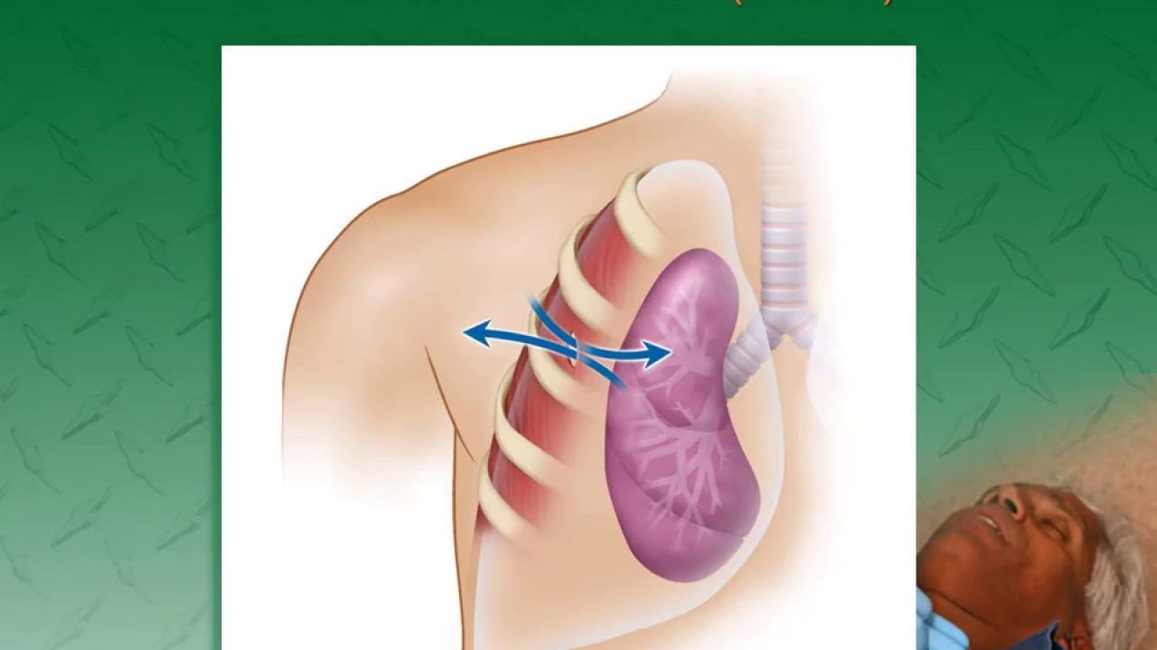 EMT Chest Injuries lecture.