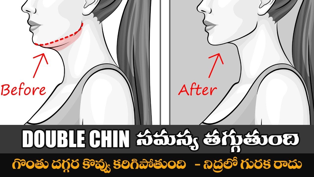 Double Chin Reducing Exercises | Burns Neck Fat | Reduces Snoring | Yoga with Dr. Tejaswini Manogna