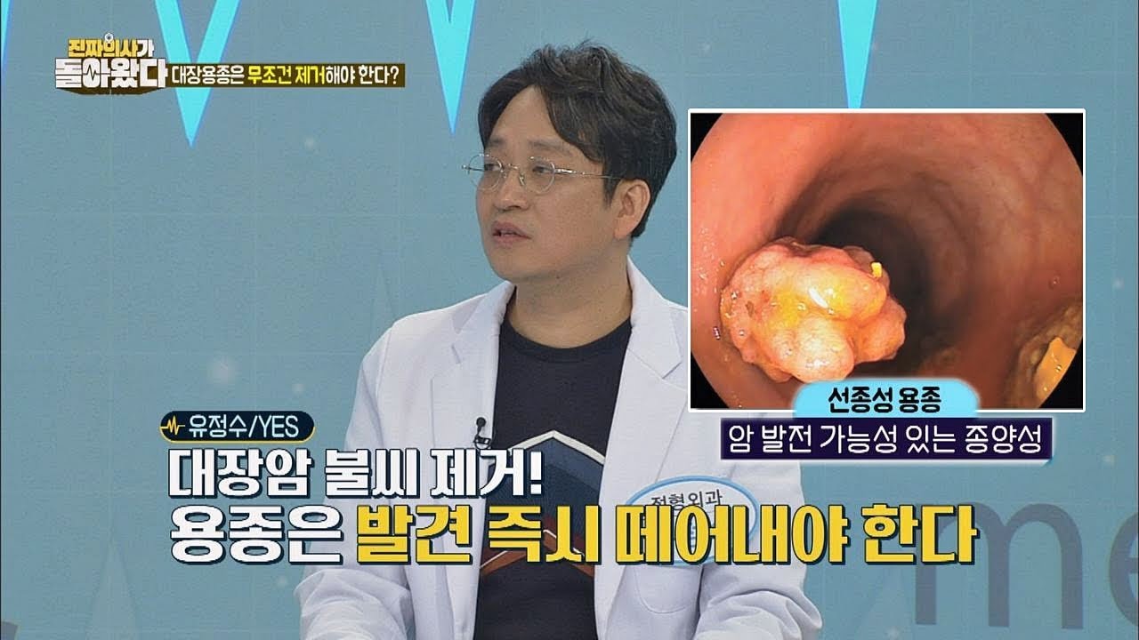 암 발전 가능 성이 있는 '선종성 용종'이라면 제거해야 한다 진짜 의사가 돌아왔다 31회