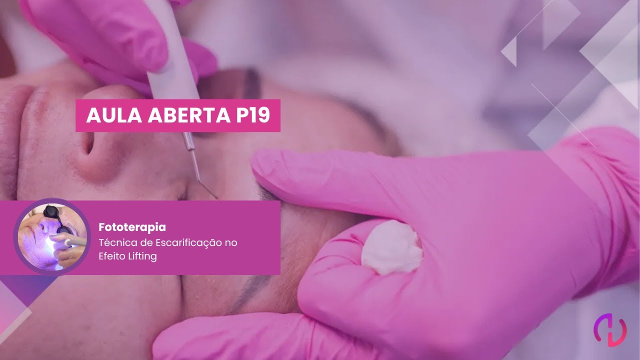 Aula Aberta #P19 - Fototerapia e Finalização - Técnica de Escarificação no Efeito Lifting