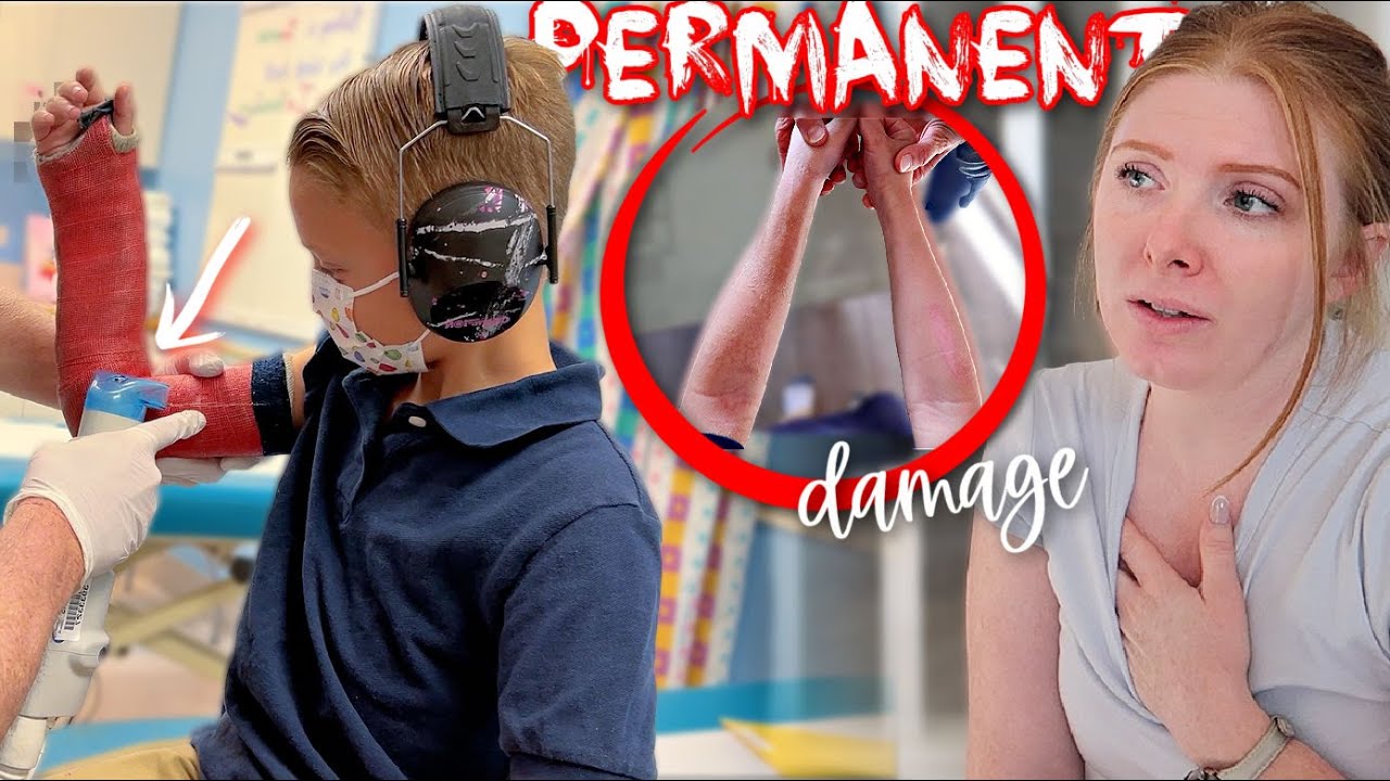 permanent DAMAGE to my son’s arm (removing his cast)