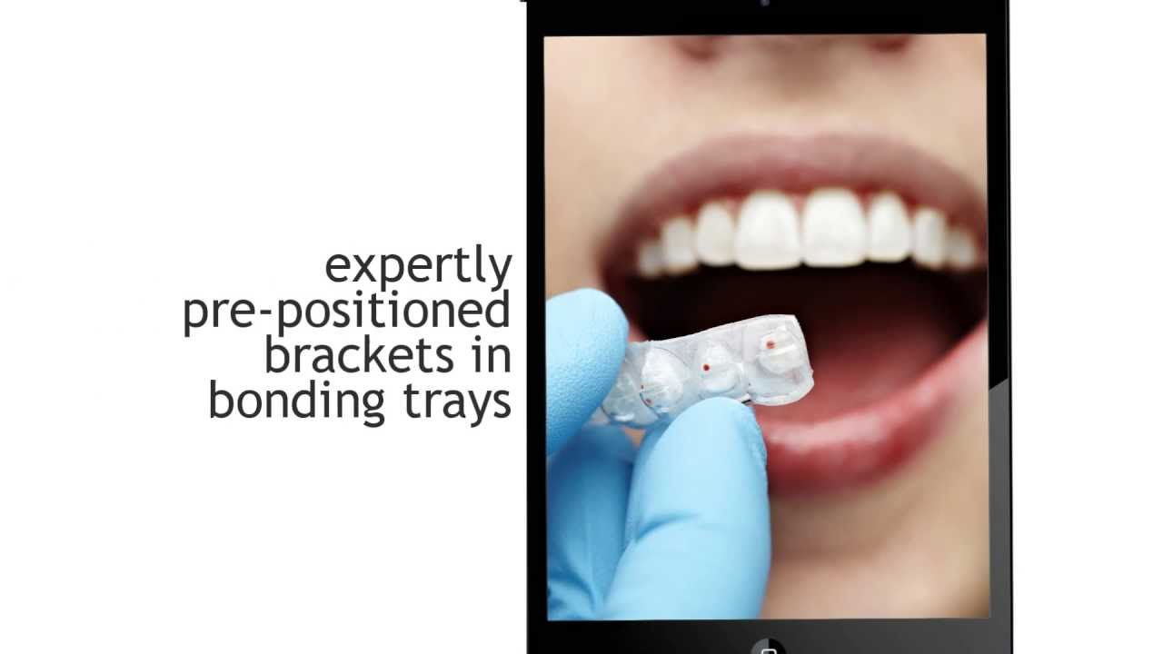 What is Six Month Smiles?
