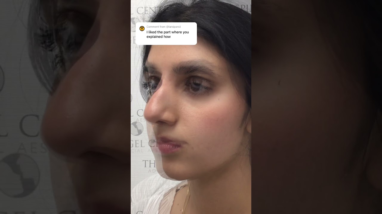 Transform your nose in minutes with NO surgery