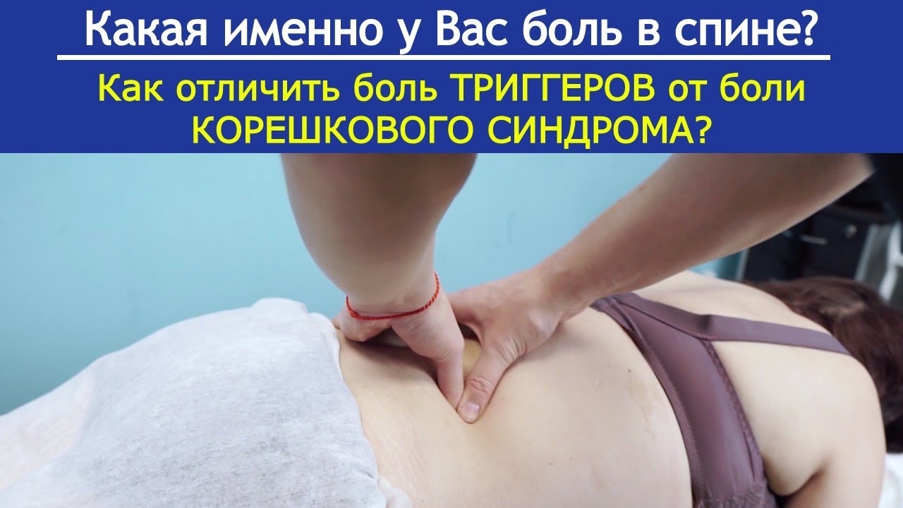 Как отличить БОЛЬ ТРИГГЕРОВ в спине от боли РАДИКУЛОПАТИИ?