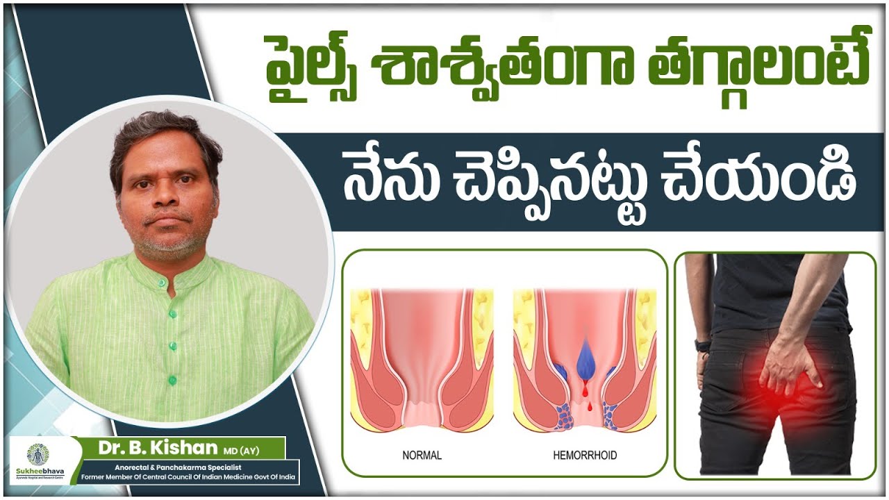 Early Symptoms of Piles in Telugu | Stages and Treatment for Piles | Sukheebhava Ayurvedic Hospitals