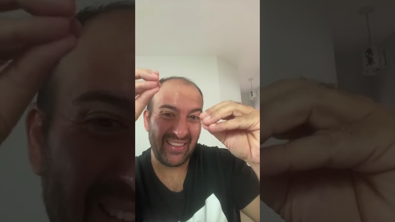 Live -  Porque nem Remédio e Nem Cirurgia Resolvem as minhas Dores na Coluna?