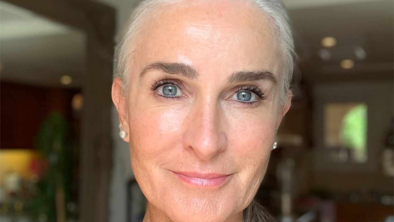 How I Removed My Hair Permanently | Caroline Labouchere | Furless Electrolysis Treatment
