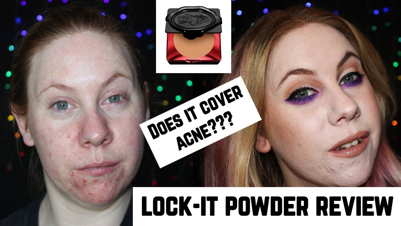 Kat Von D Lock-It Powder Foundation Review on Dry Acne Skin