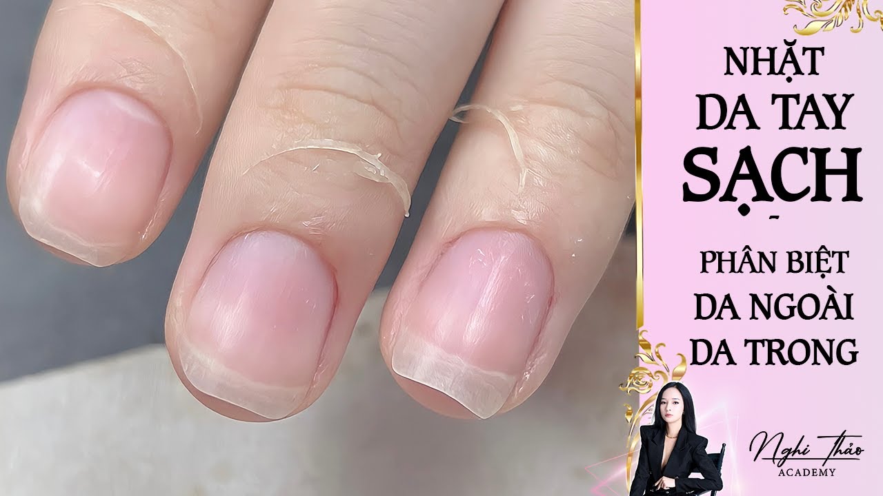 Nhặt da tay sạch: phân biệt da ngoài, da ẩn