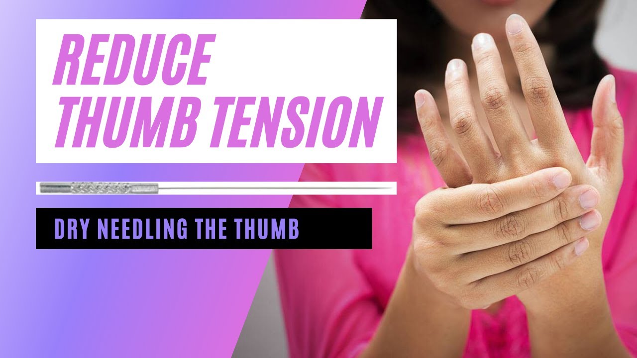 Dry Needling Hand - Needling treatment for hand and thumb pain by a physio