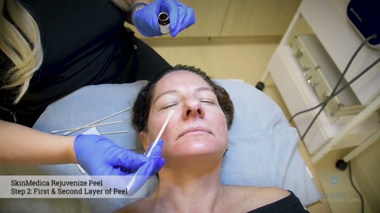 SkinMedica Rejuvenizing Peel