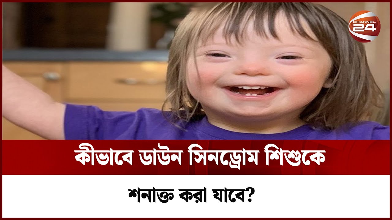 কীভাবে ডাউন সিনড্রোম শিশুকে শনাক্ত করা যাবে? | Channel 24