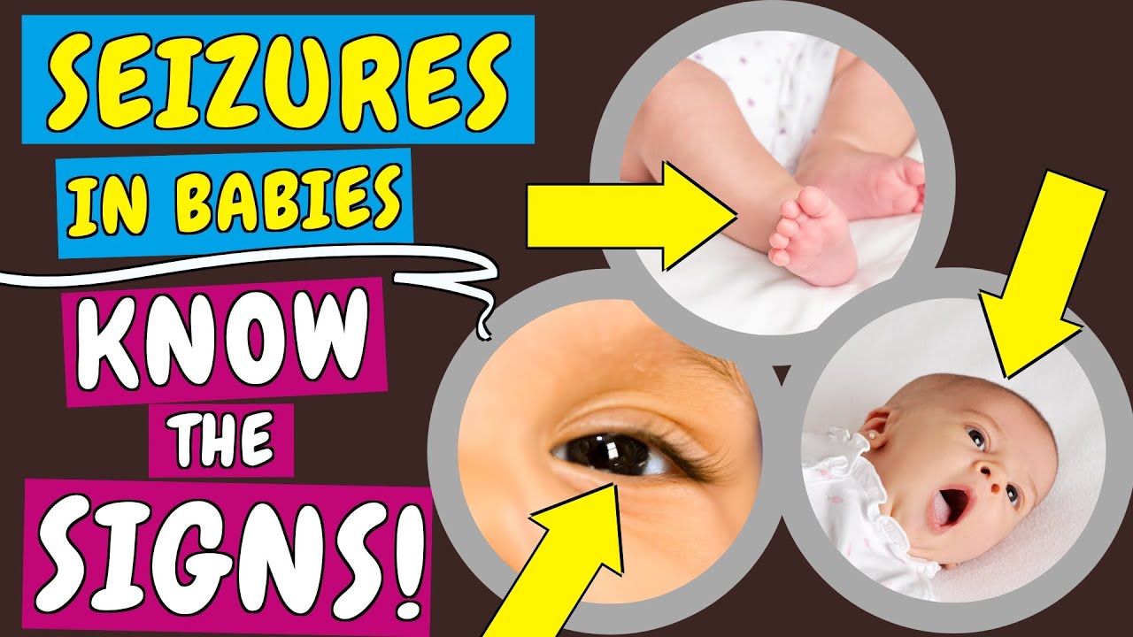 Seizures in Babies: Signs, Causes and what to do when your Baby has a Seizure