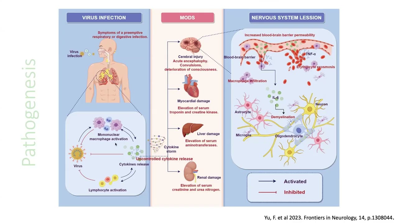 Influenza Acute Necrotizing Encephalopathy