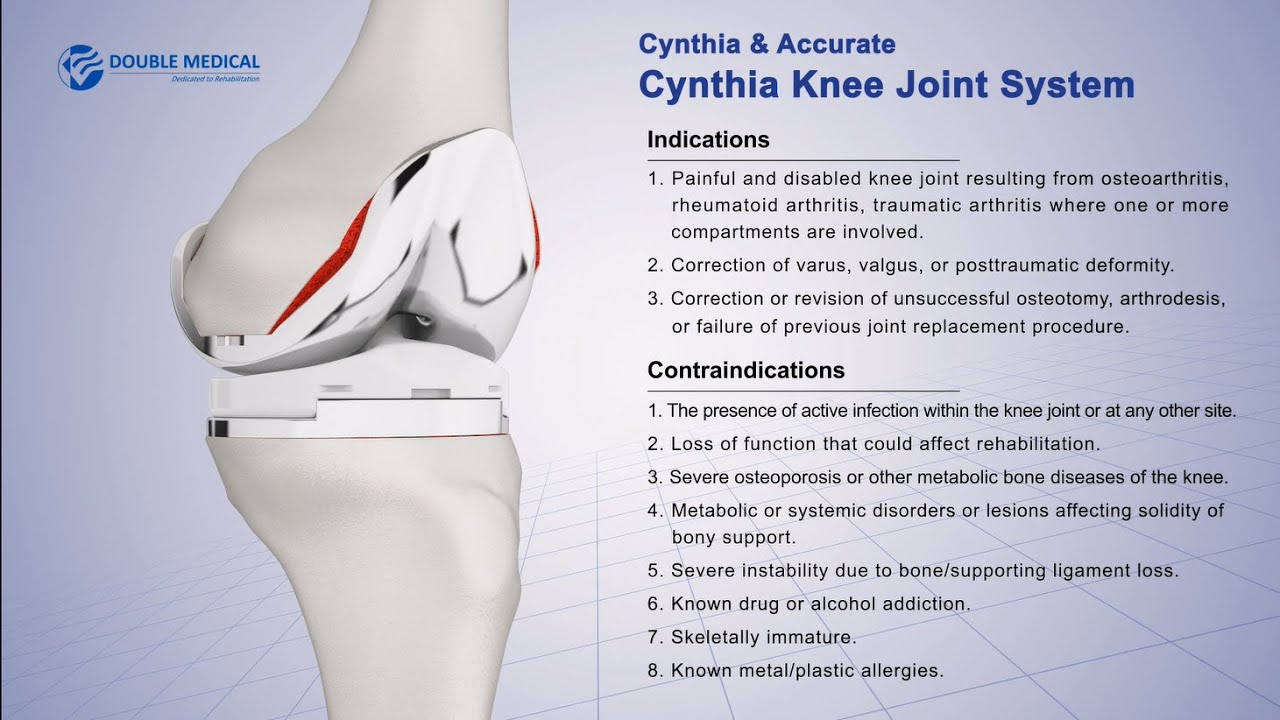 Double Medical Cynthia Knee Joint