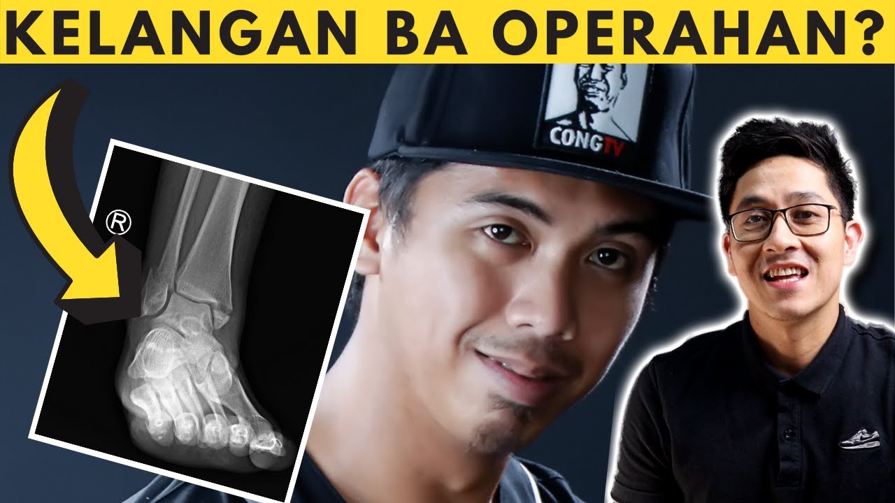 DOCTOR REACTS: @CongTheVlogger INJURY