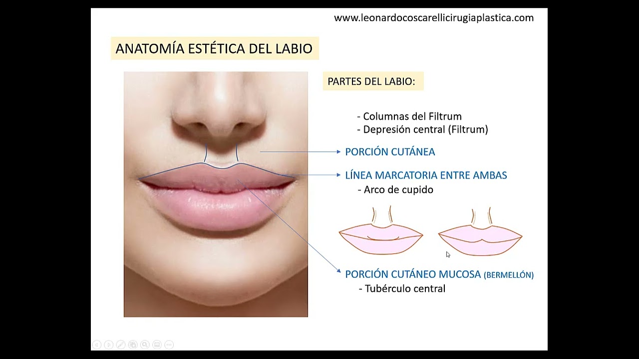 Cirugía de labios