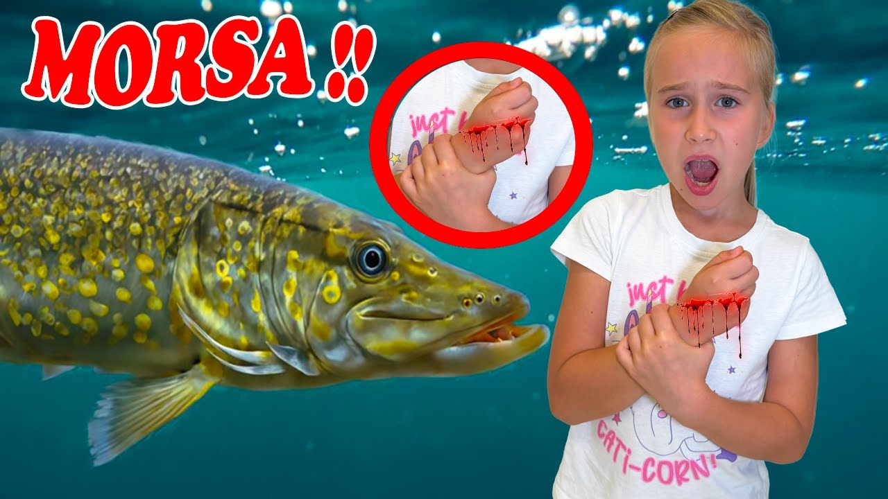 ERIKA È STATA MORSA DA UN PESCE E SI FA MALE! 😱😱