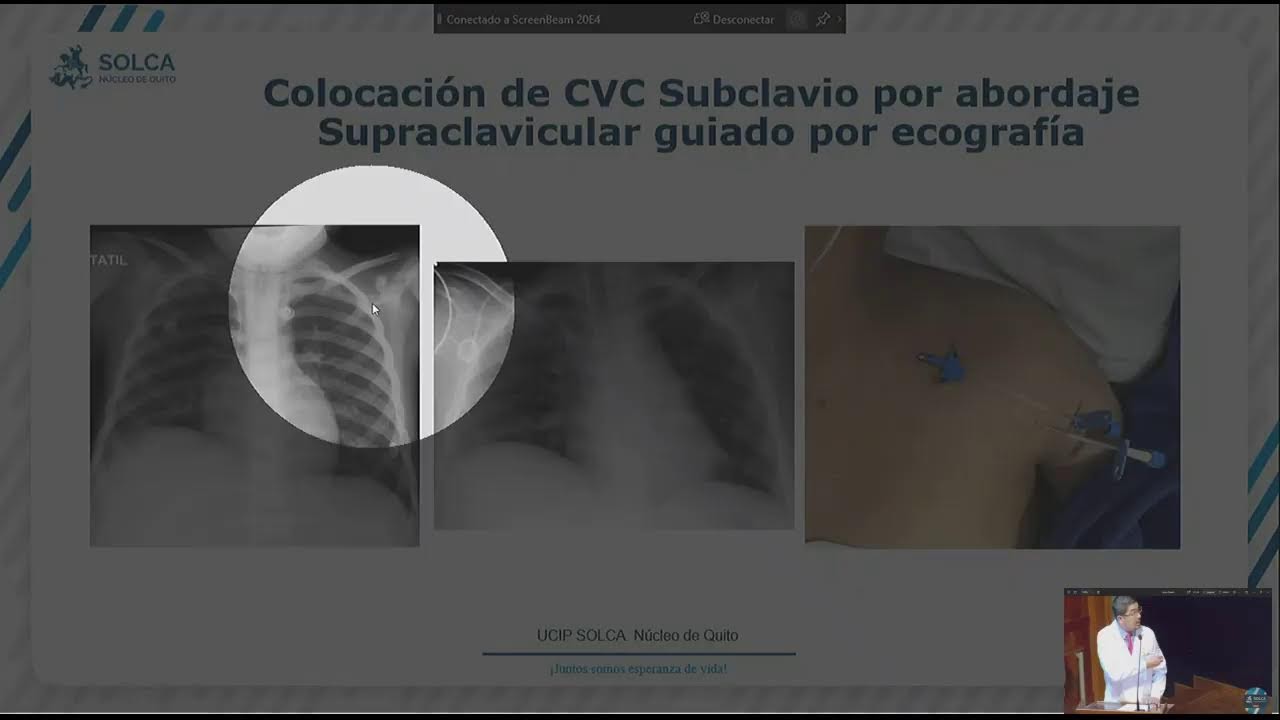 Transformando la Atención Pediátrica Oncológica: Avances, Retos e Impacto SOLCA Quito Live Stream