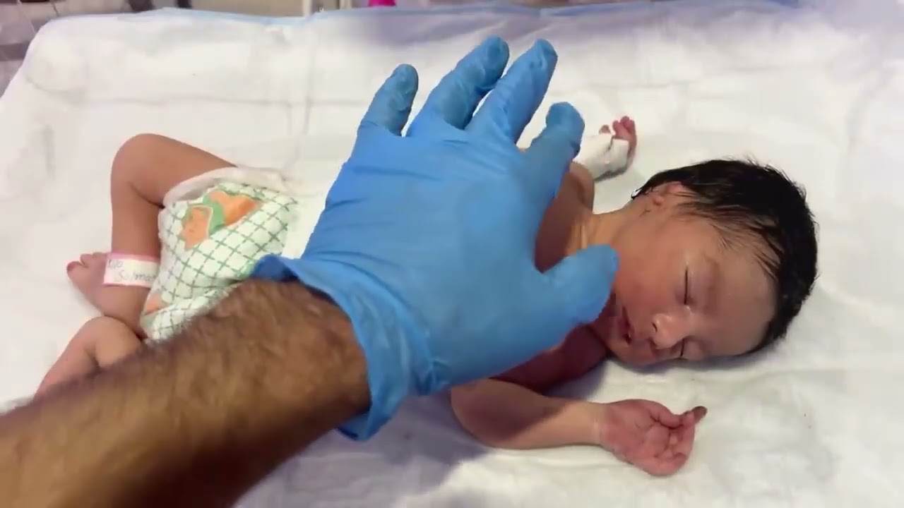 Day-54 baby treatment🩺😷.!#aiims#nicu#hospital#medicallife#newbornbaby#cutebaby#treatment#shortsfeed