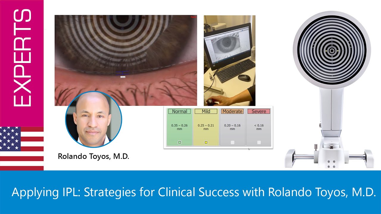 Applying IPL: Strategies for Clinical Success with Rolando Toyos, M.D.