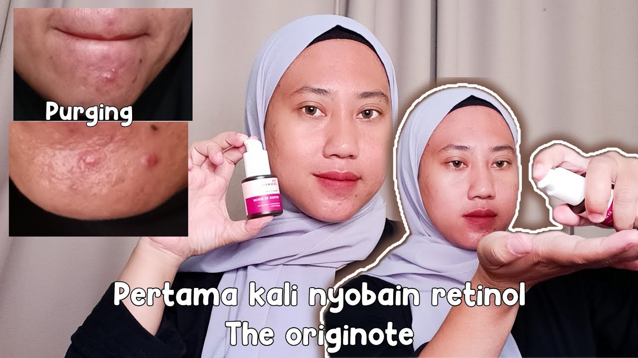 Pertama kali nyobain serum RETINOL THE ORIGINOTE!!