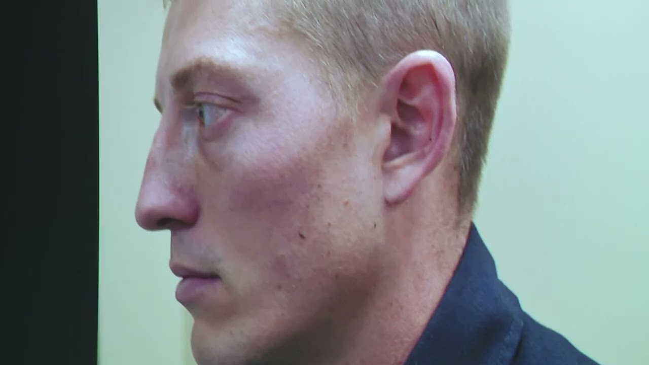 Jury sees photos of Christopher Schurr's injuries during murder trial