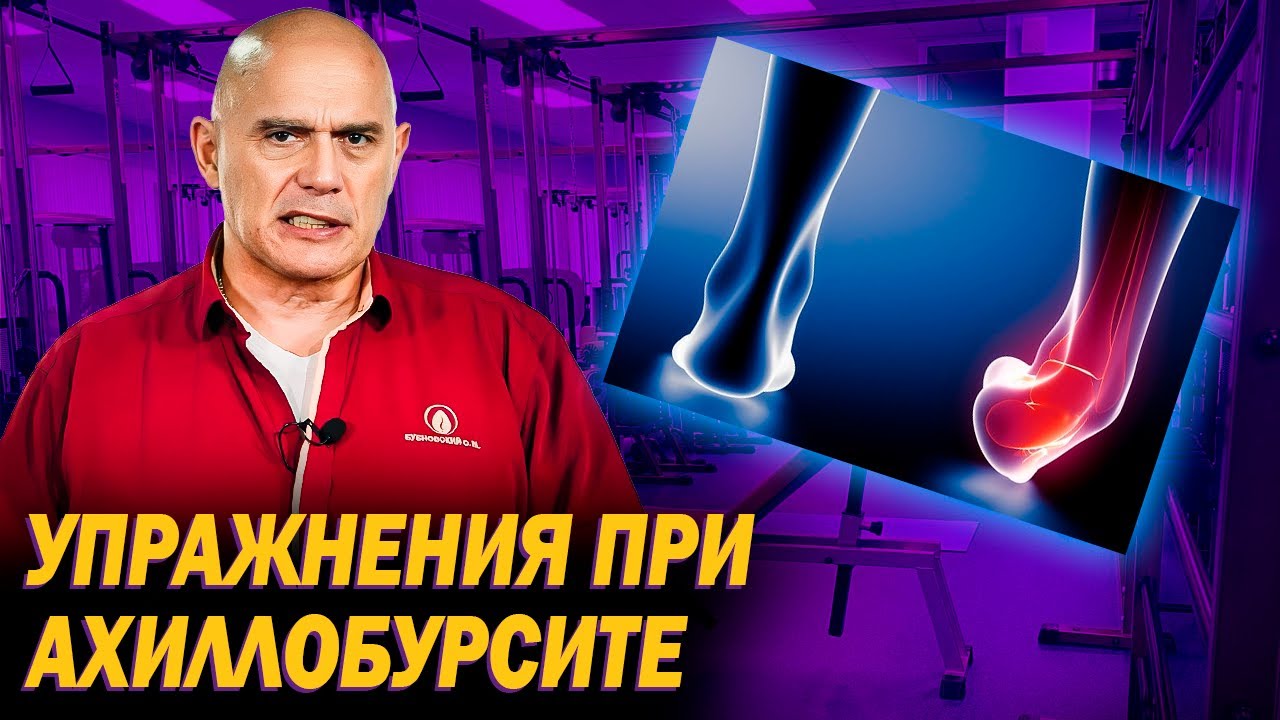Причины появления ахиллобурсита. Как лечить воспаление сустава стопы упражнениями?