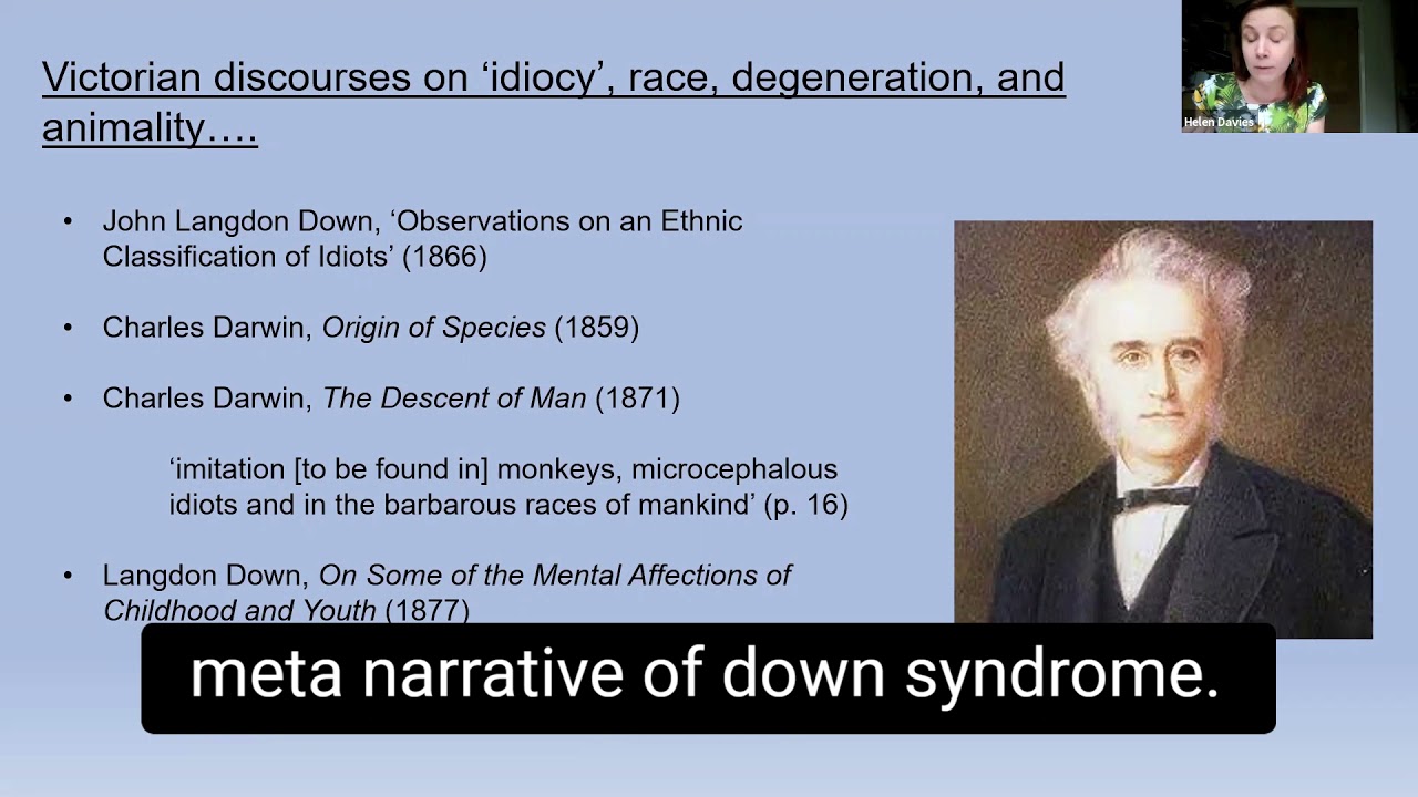 Metanarrative of Down Syndrome