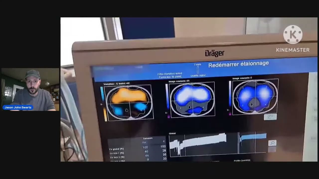 PulmoVista 500 Guided Recruitment of Dorsal Atelectasis Using APRV + Prone Position