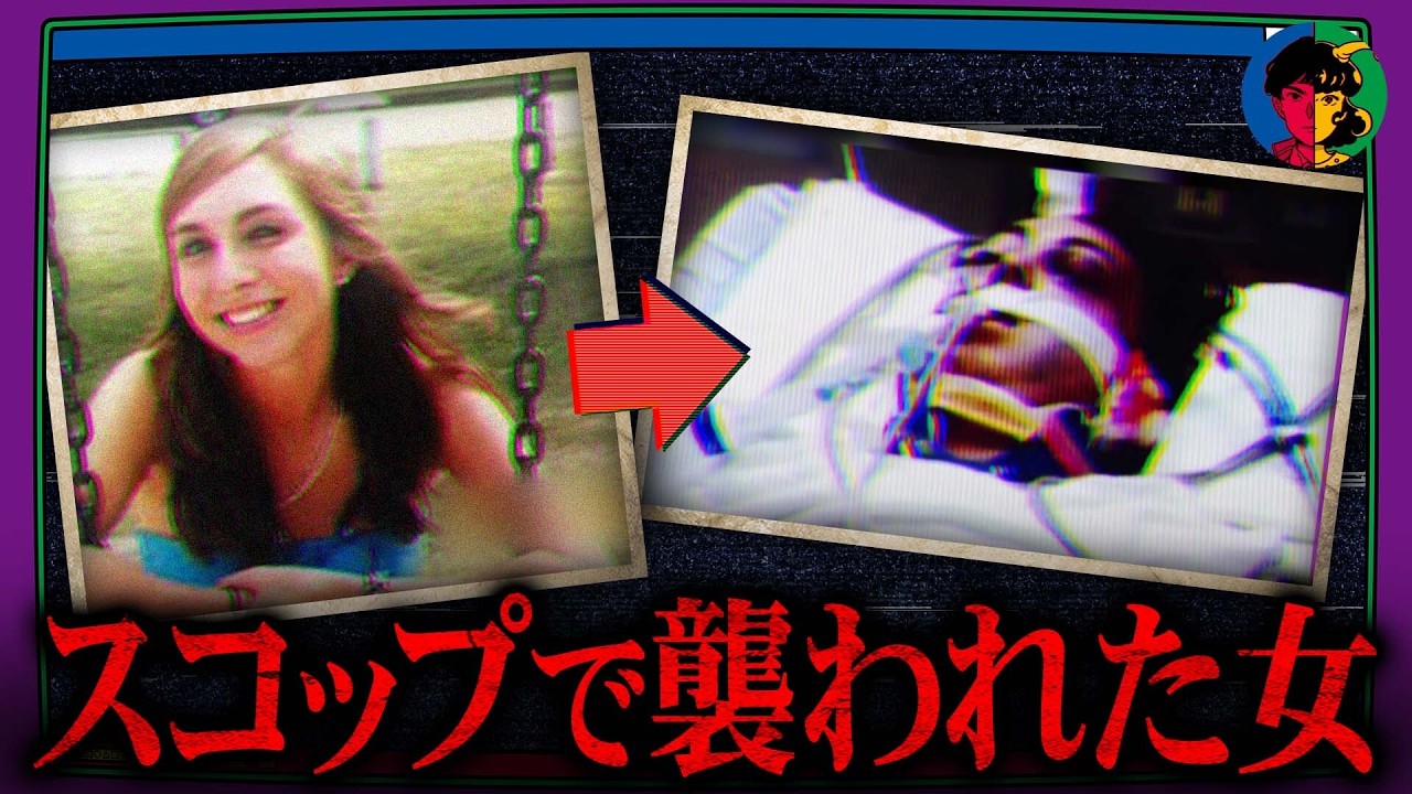 スコップで襲撃された美女…催眠療法が解き明かす真犯人とは？