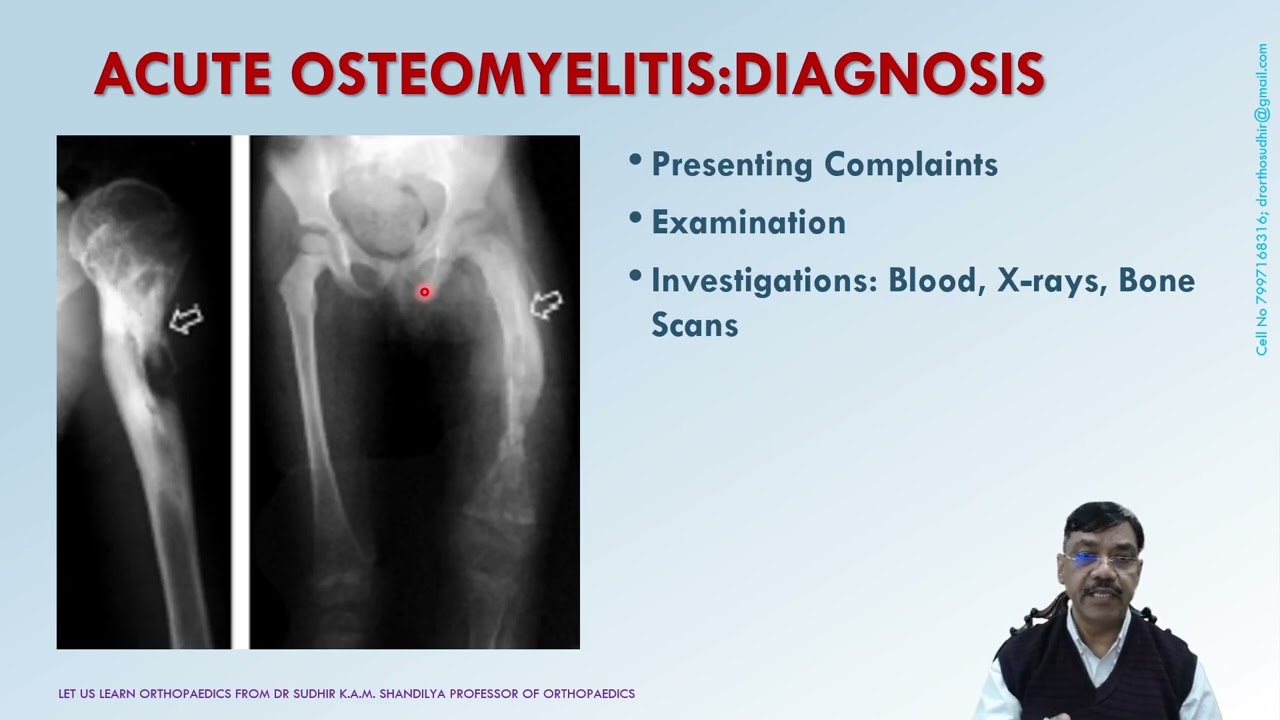 Acute Osteomyelitis - A Lecture by Prof Dr Sudhir K.A.M. Shandilya