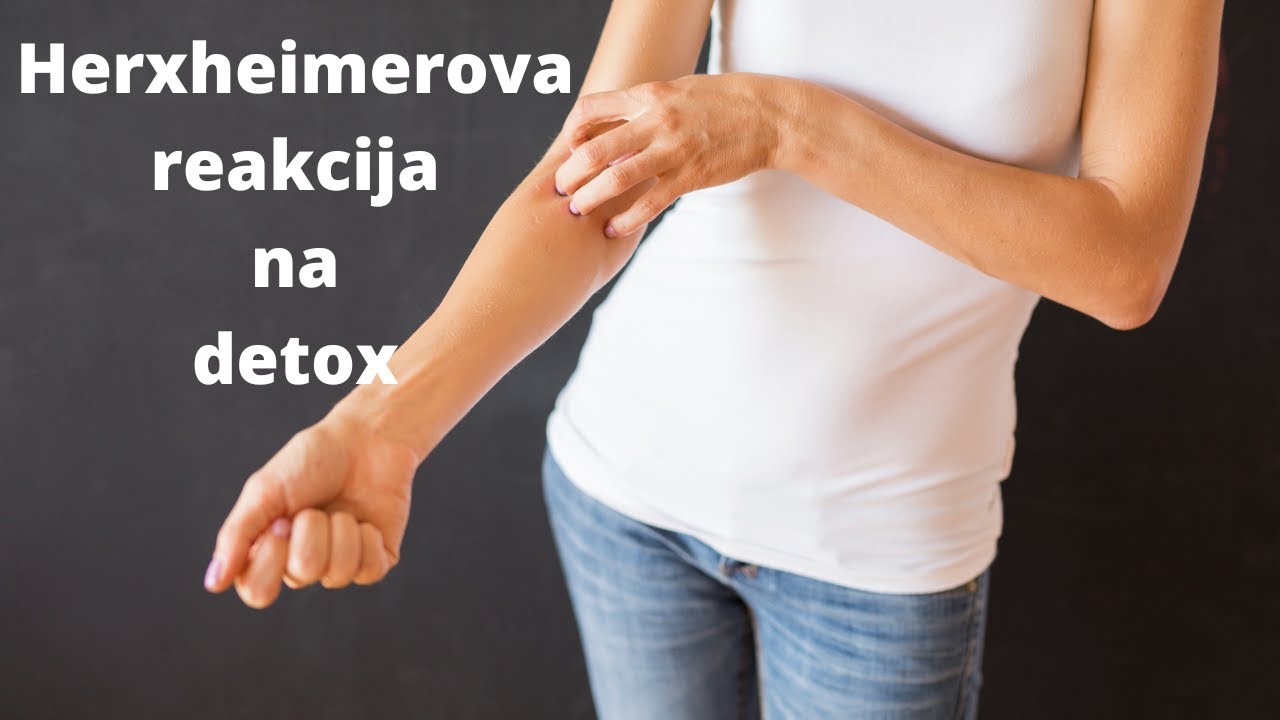 Herx reakcija - reakcija na detox