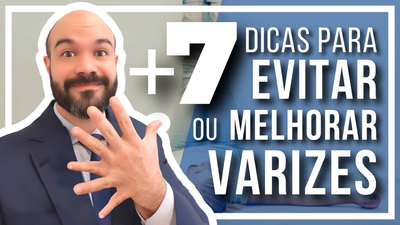 🔴7 DICAS PR&Aacute;TICAS de como Evitar ou Melhorar suas Varizes (para implementar HOJE)