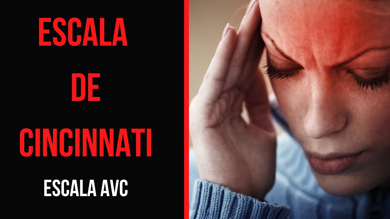ESCALA DE CINCINNATI: AVALIAÇÃO DO AVC
