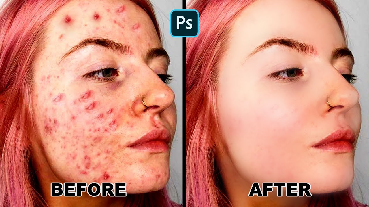 CARA MENGHALUSKAN WAJAH RUSAK DENGAN PHOTOSHOP
