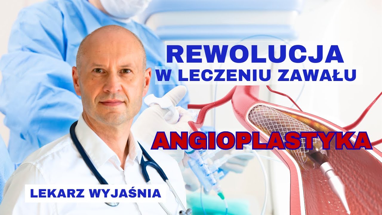 Angioplastyka nie leczy miażdżycy – ale ratuje życie! Zawał, koronarografia, angioplastyka, stent.