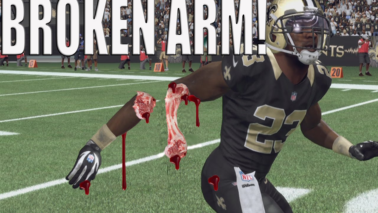 BROKEN ARM WTF! MADDEN NFL 16 - OVERTIME BEST CLUTCH GAME EVER! MUT 16 Gameplay