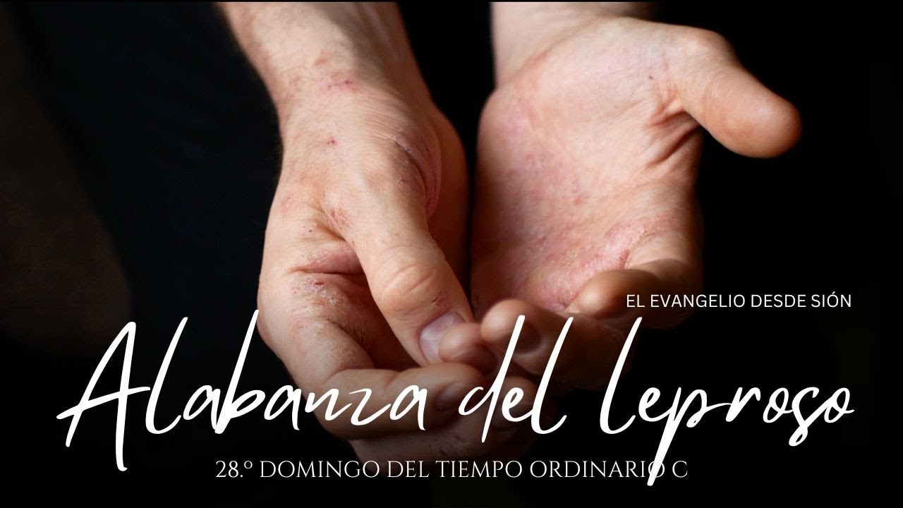 Alabanza del Leproso