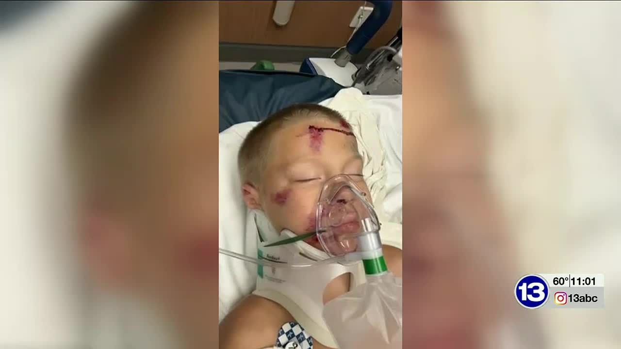 6-year-old boy recovering after being hit by car