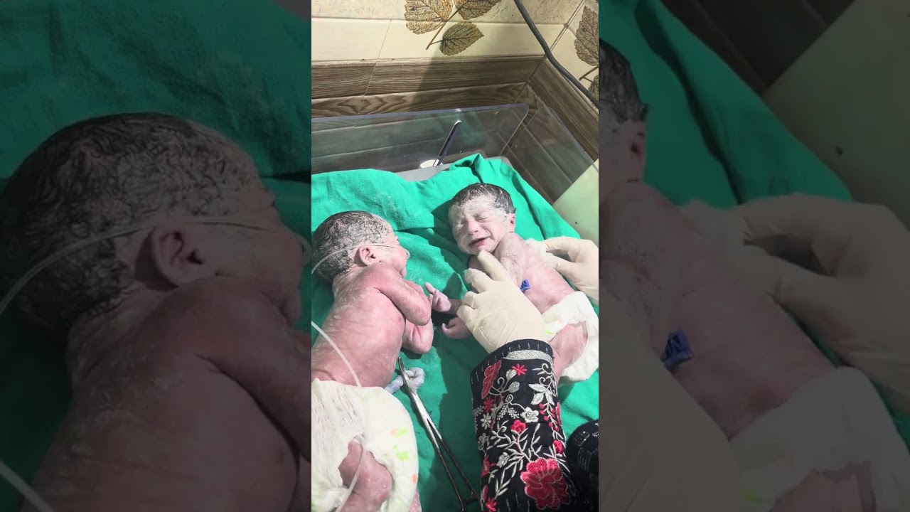 Twins pregnancy #newbornbaby #cute #baby #infant #cutebabies 