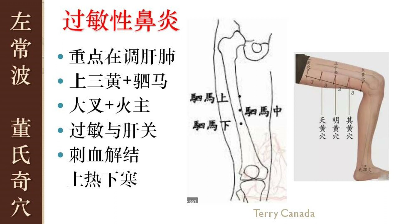 4.14 过敏性鼻炎 调肝肺 | 左常波 董氏针灸 刺血 解结  | Master Tung Acupuncture Points