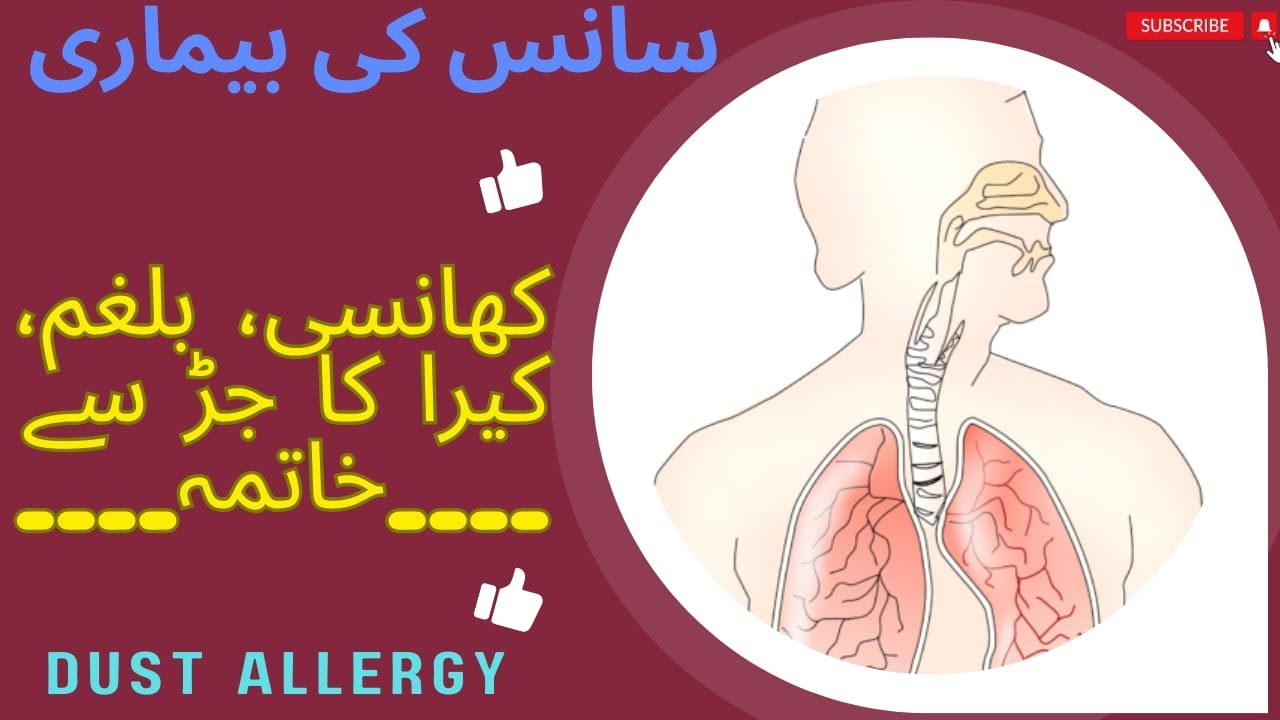 khansi ka ilaj || Asthma || Homeotips by doctor Akram