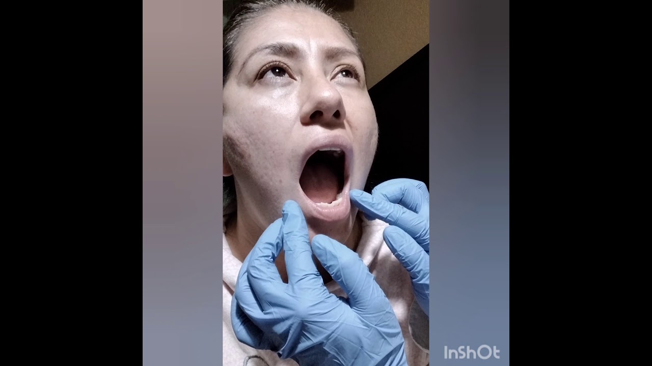 Interrogatorio - Exploración de Cabeza, Cuello y Cavidad Oral