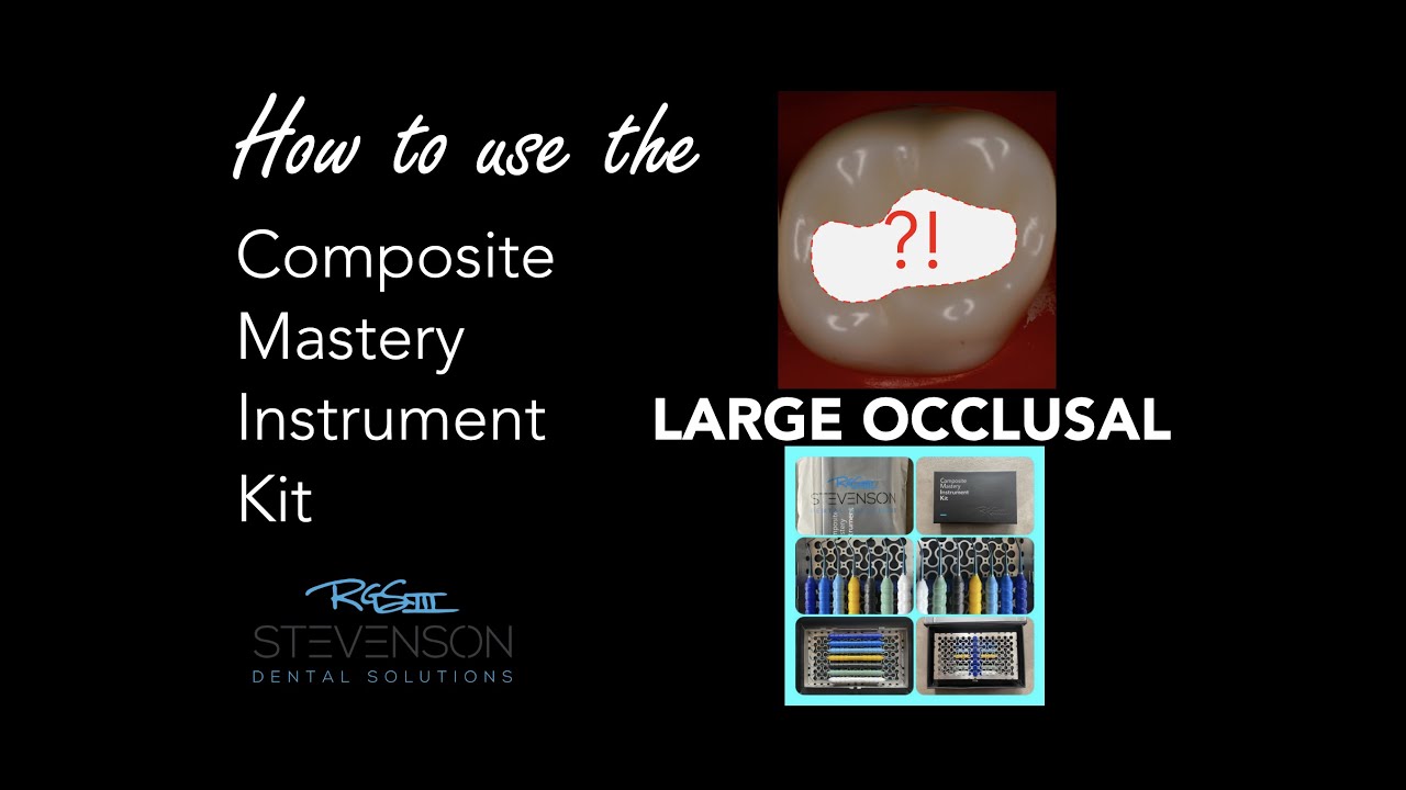 How to Use the Composite Mastery Kit - Large Occlusal