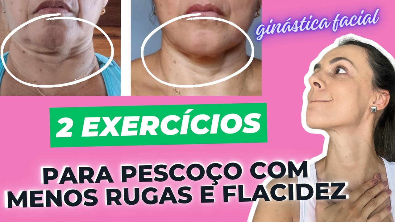 Tchau rugas e flacidez no Pescoço de forma 100% natural! Faça junto!