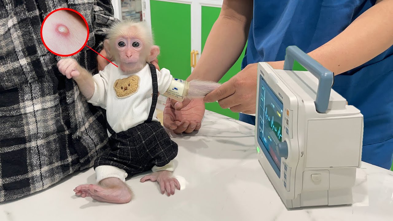 OMG! Baby monkey Zika was bitten by an insect on his neck, his dad takes him to see a doctor