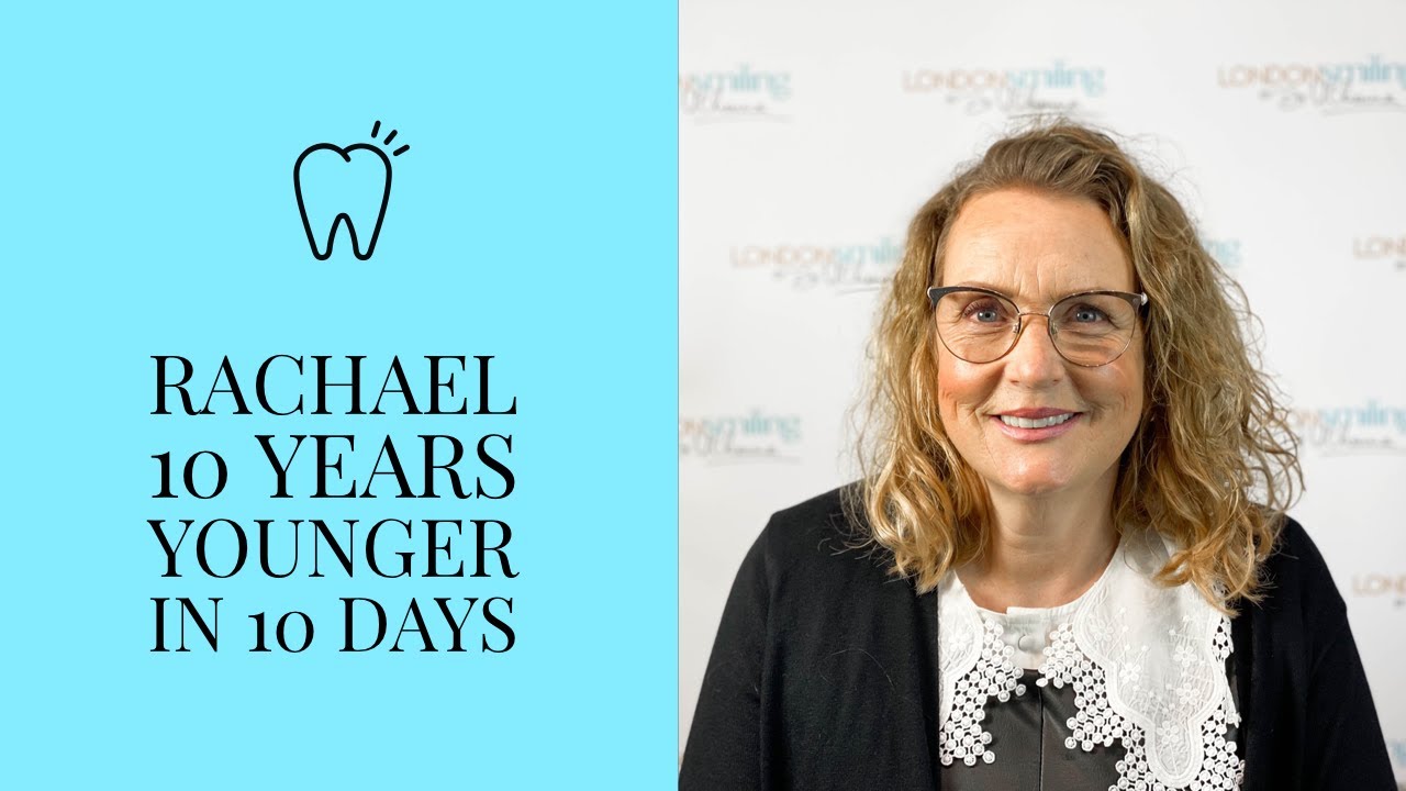 Rachael from 10 years younger in 10 Days talks about her dental treatment & new found confidence