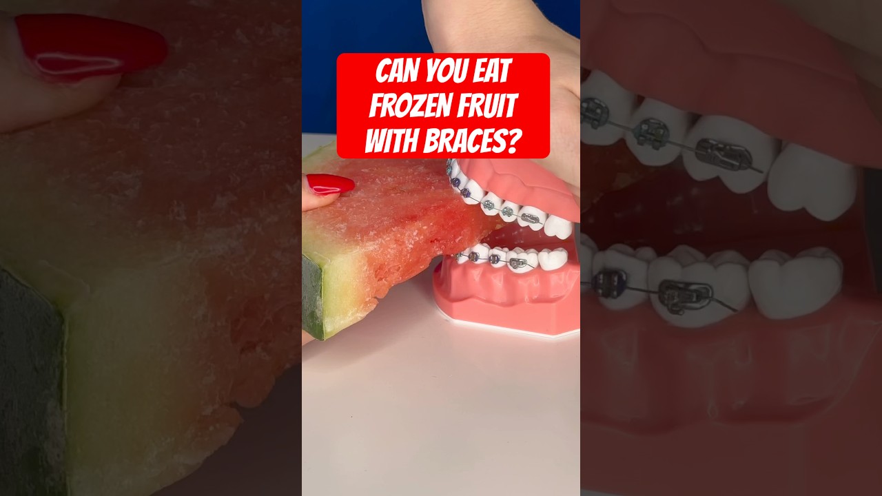Can you eat FROZEN FRUIT with BRACES? ASMR #braces #watermelon #fruit
